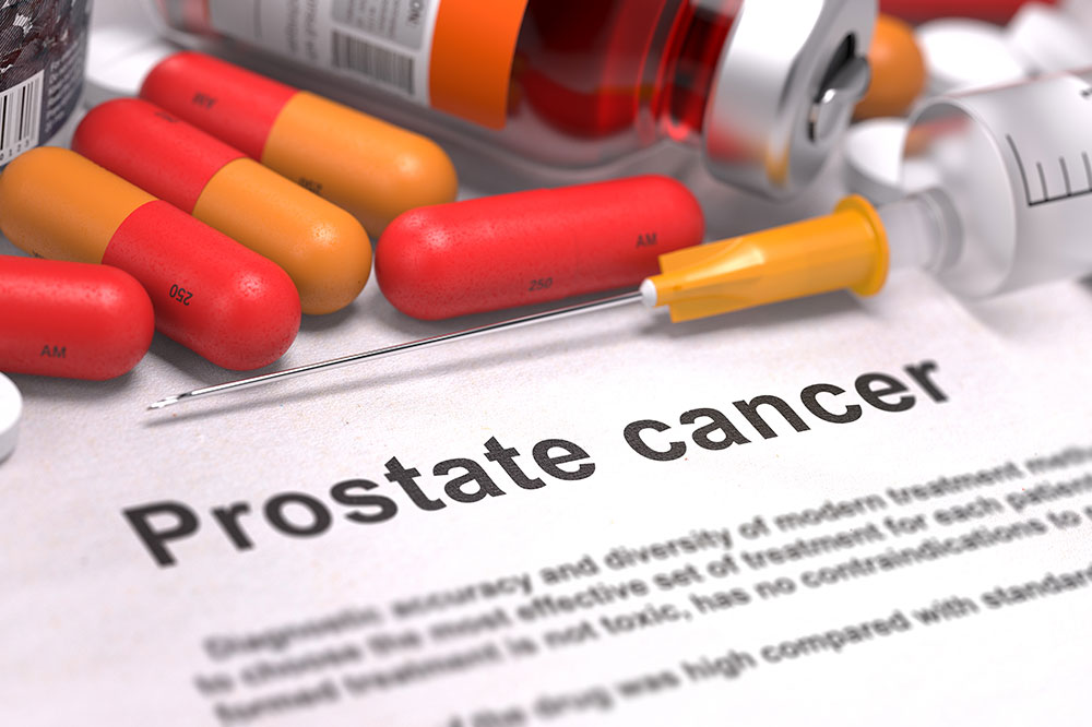 4 Causes of Prostate Cancer