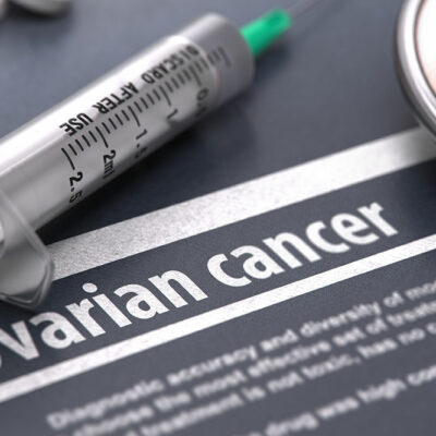 5 Major Complications of Ovarian Cancer