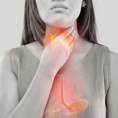 6 Major Causes of Acid Reflux