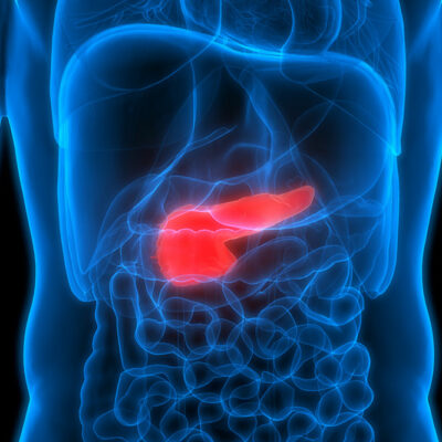 6 Early Warning Symptoms of Pancreatic Cancer