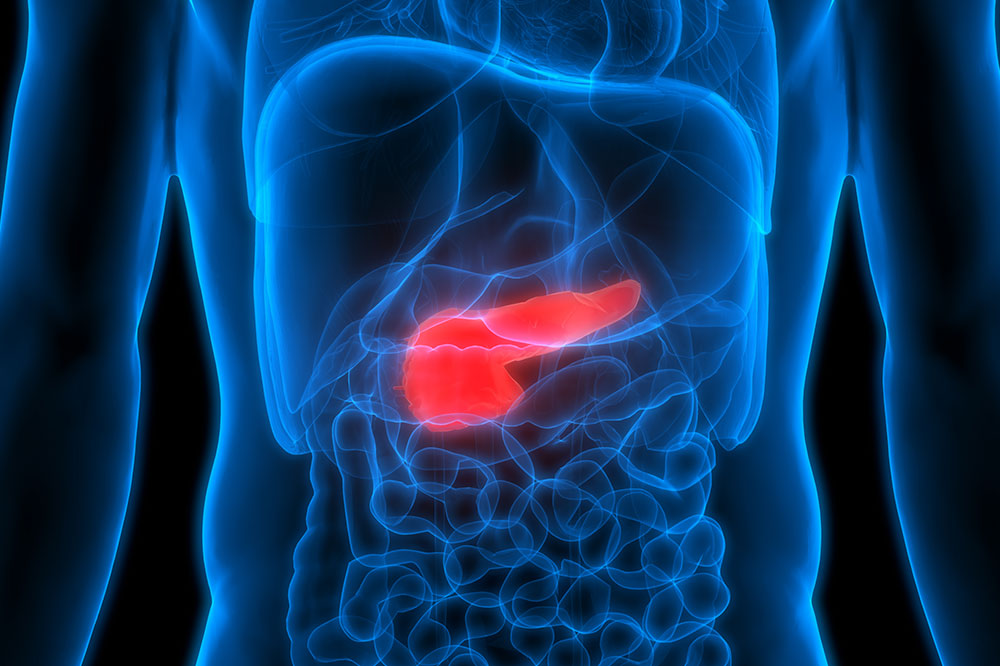 6 Early Warning Symptoms of Pancreatic Cancer