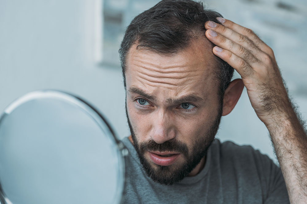 6 Hair Loss Treatments for Men
