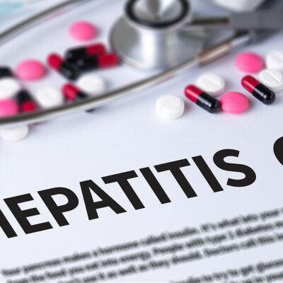 Common Complications of Hepatitis C