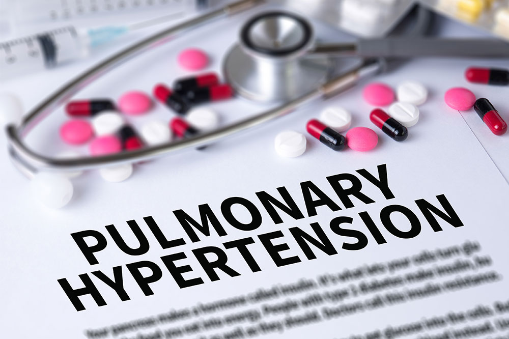 Major Signs and Symptoms of PAH