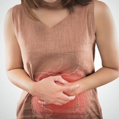 Ulcerative Colitis – Symptoms and Trigger Foods