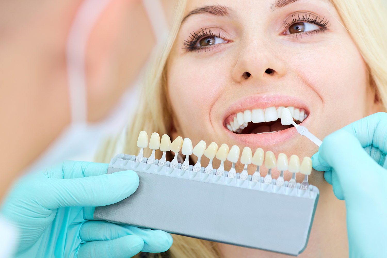 Dental Implants or Dentures: Which One is Better?